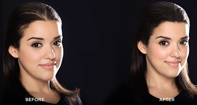 Minoxidil před a po